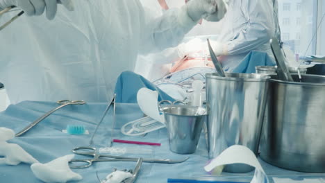 scrub nurse prepares sterile instrument. woman medic takes tool assisting surgeon by providing supplies during coronary artery bypass graft surgery