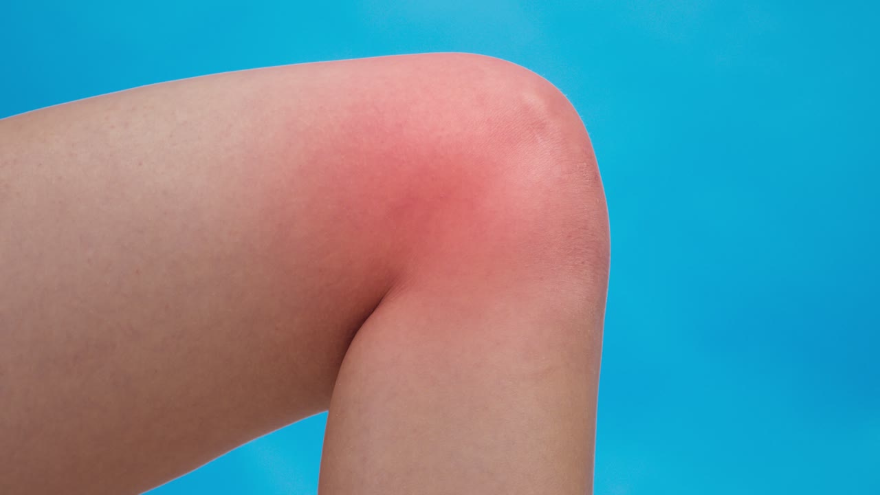 Painful Knee