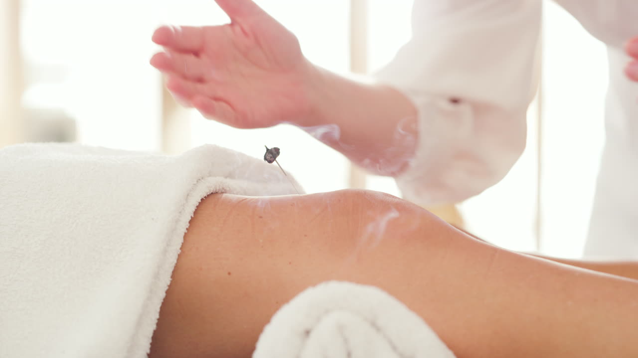 마사지사가 무 ⁇  부상을 건조한 바늘로 치료하고 있습니다.