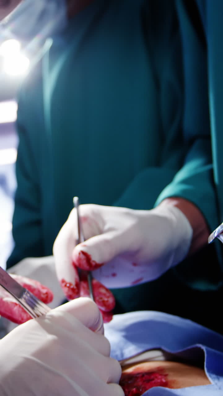 cirujanos que realizan una operación en la sala de operaciones