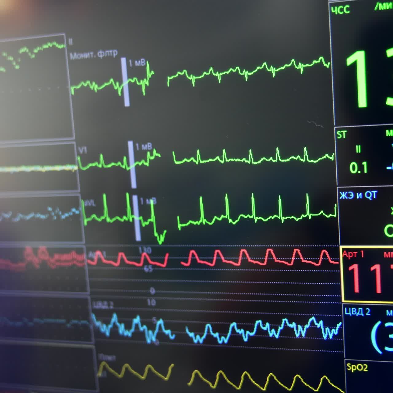 Heart rate, pulse and oxygen levels reflecting on the monitor of lung ventilator. Close up. Equipment working in the surgery room