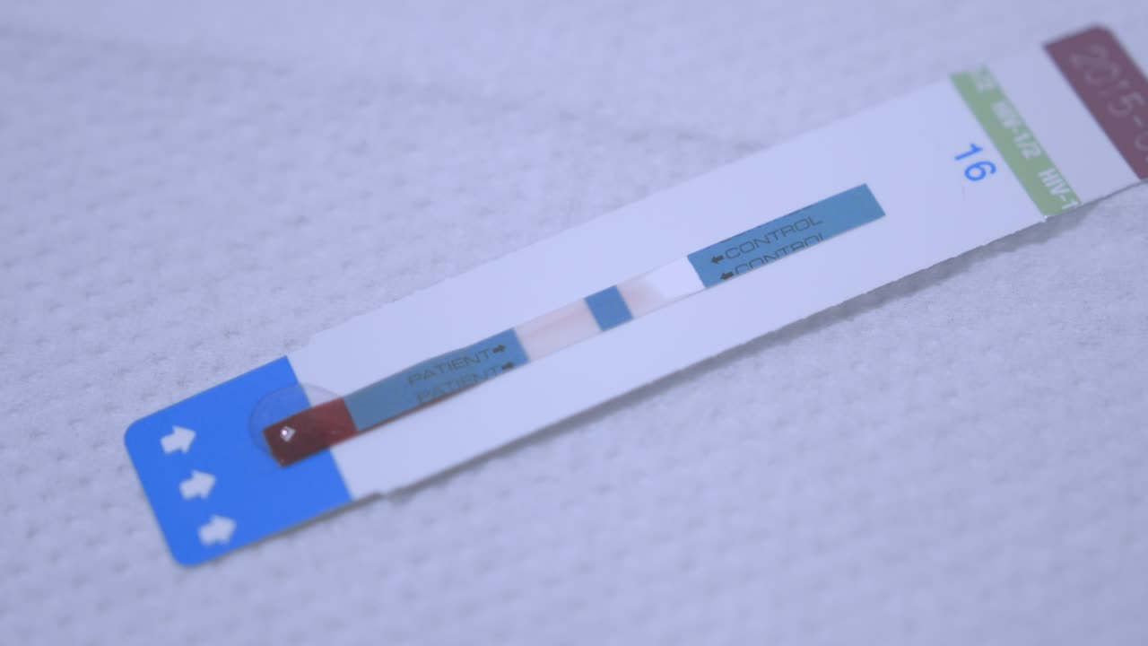 Blood testing for hiv virus. Hiv testing strip