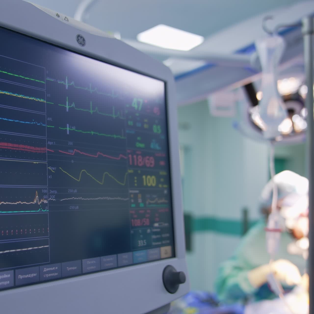 Monitor che mostra i segni vitali del paziente operato. Chirurgo e infermiera eseguono l'operazione sullo sfondo in режиме sfocato.