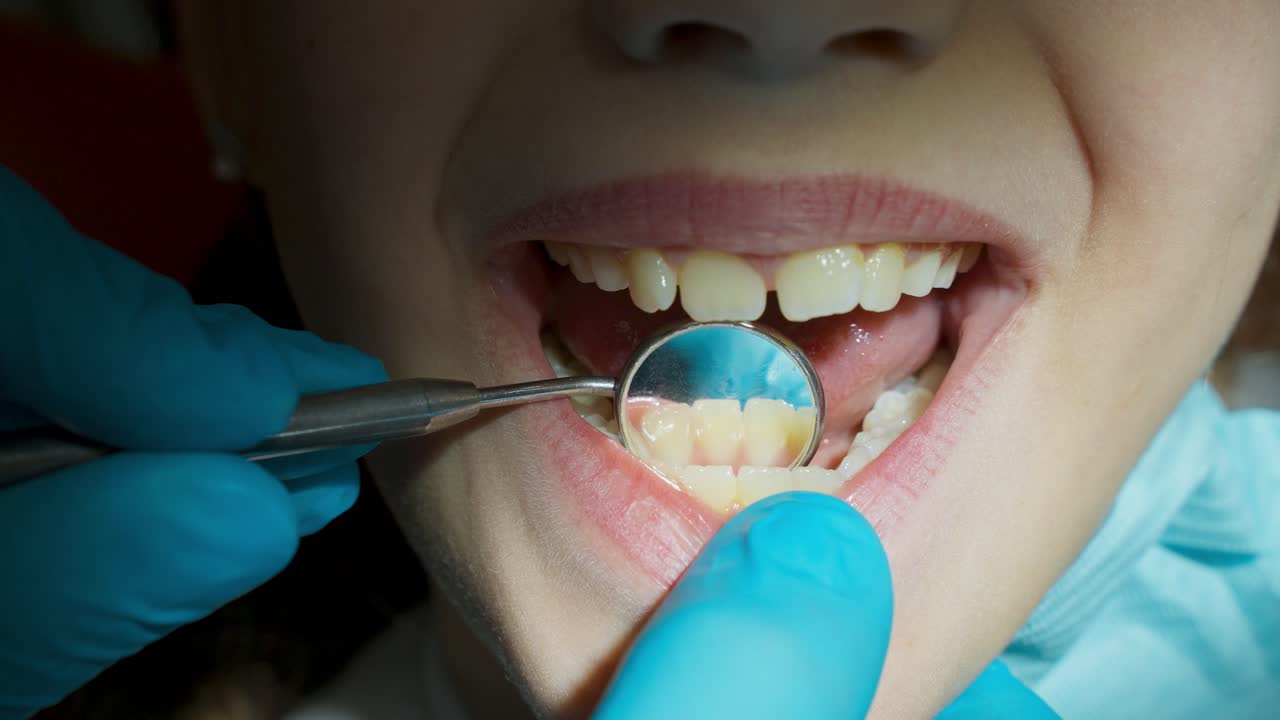 examen dental de un niño