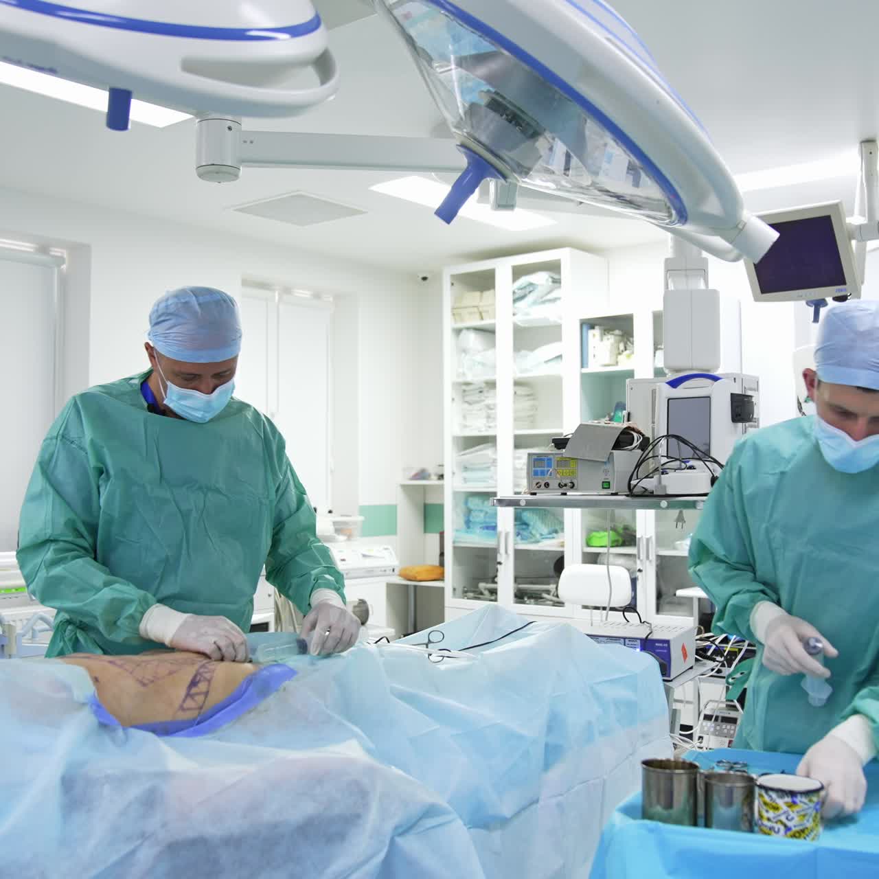 Surgeon and assistant are performing surgery on belly. Liposuction process in hospital operating room. Plastic surgery for pumping fat. Healthcare