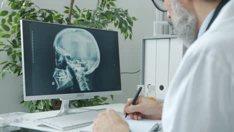 doctor reviewing x-ray of skull