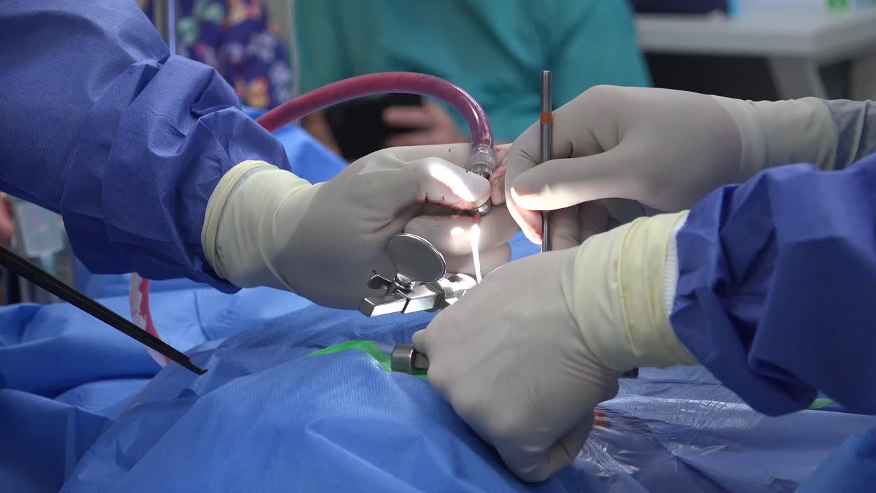 Spine Surgery Explained: Common Procedures, Recovery Expectations, Risks, and Advances in Minimally Invasive Techniques for Treating Chronic Back Pain and Spinal Disorders"