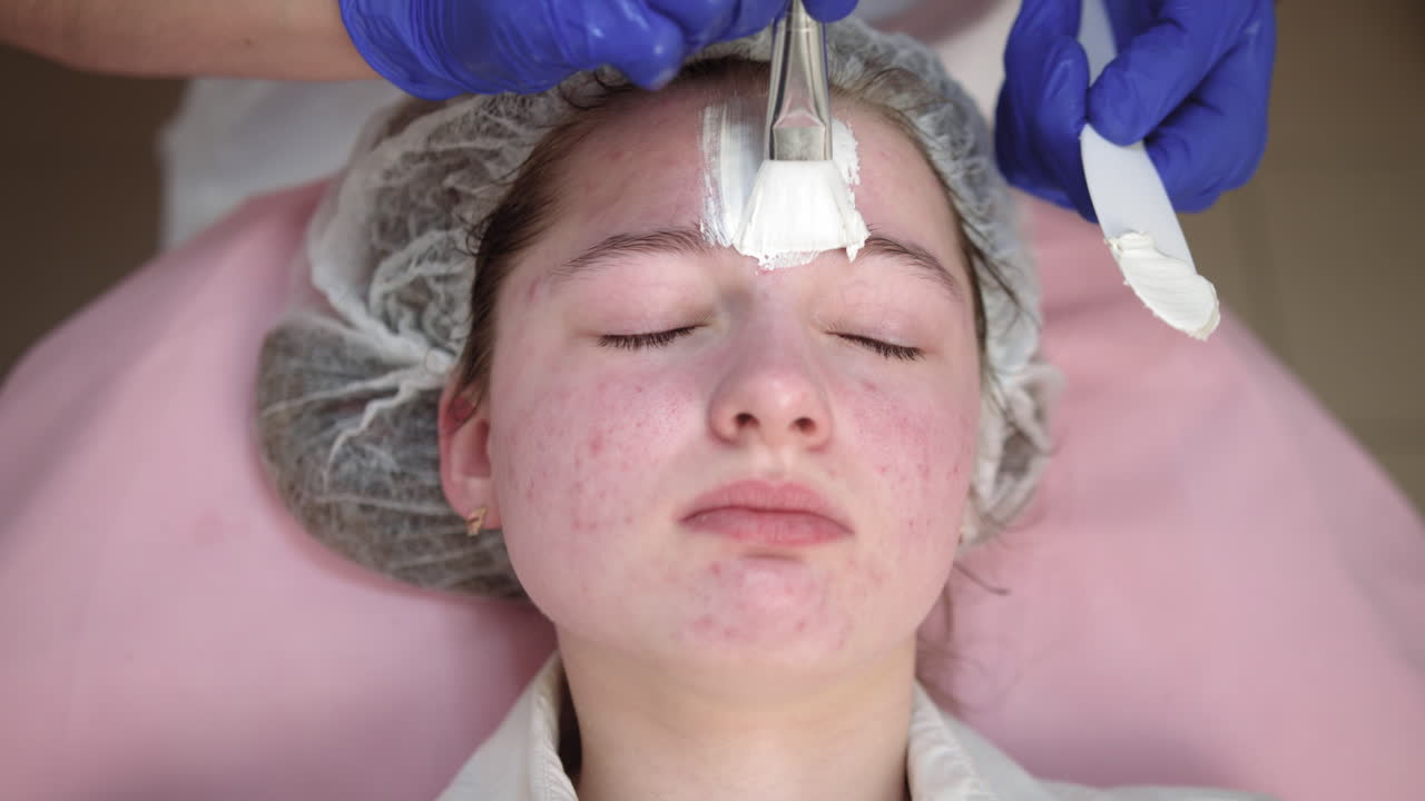 얼굴 치료를 받는 여성