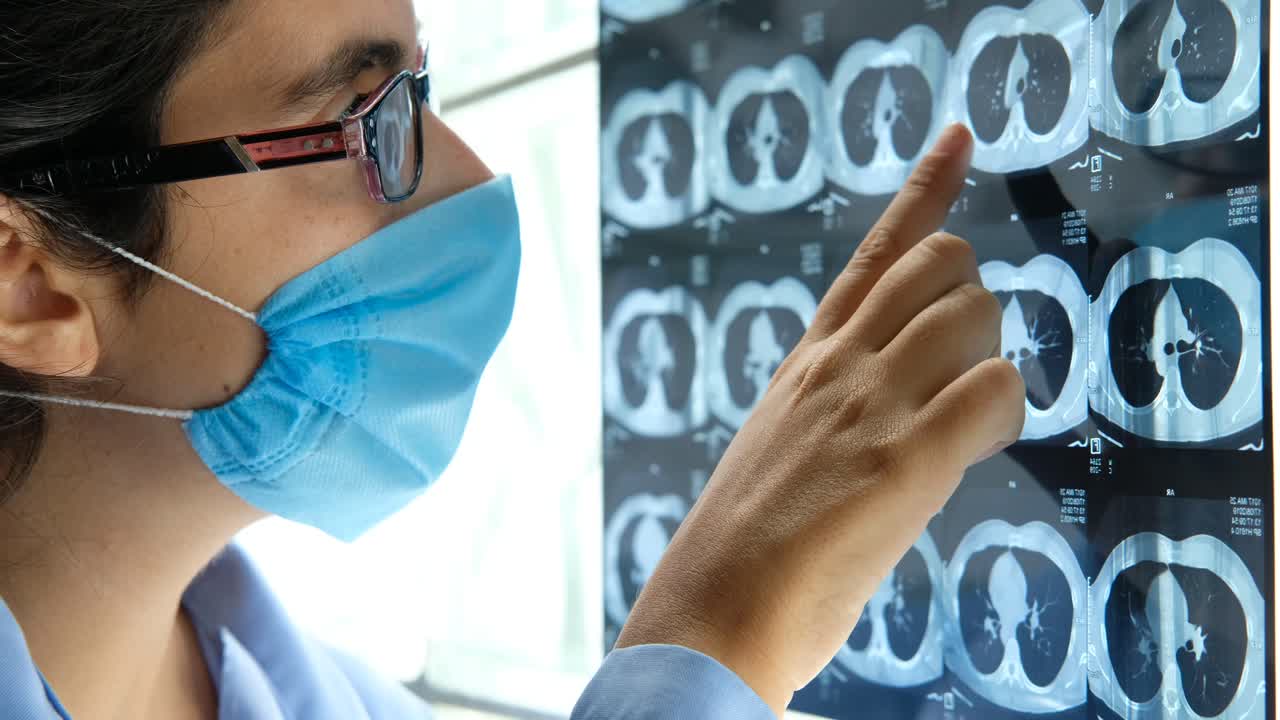 medico femminile che esamina la tomografia del torace, la scansione tc dei raggi x della malattia polmonare