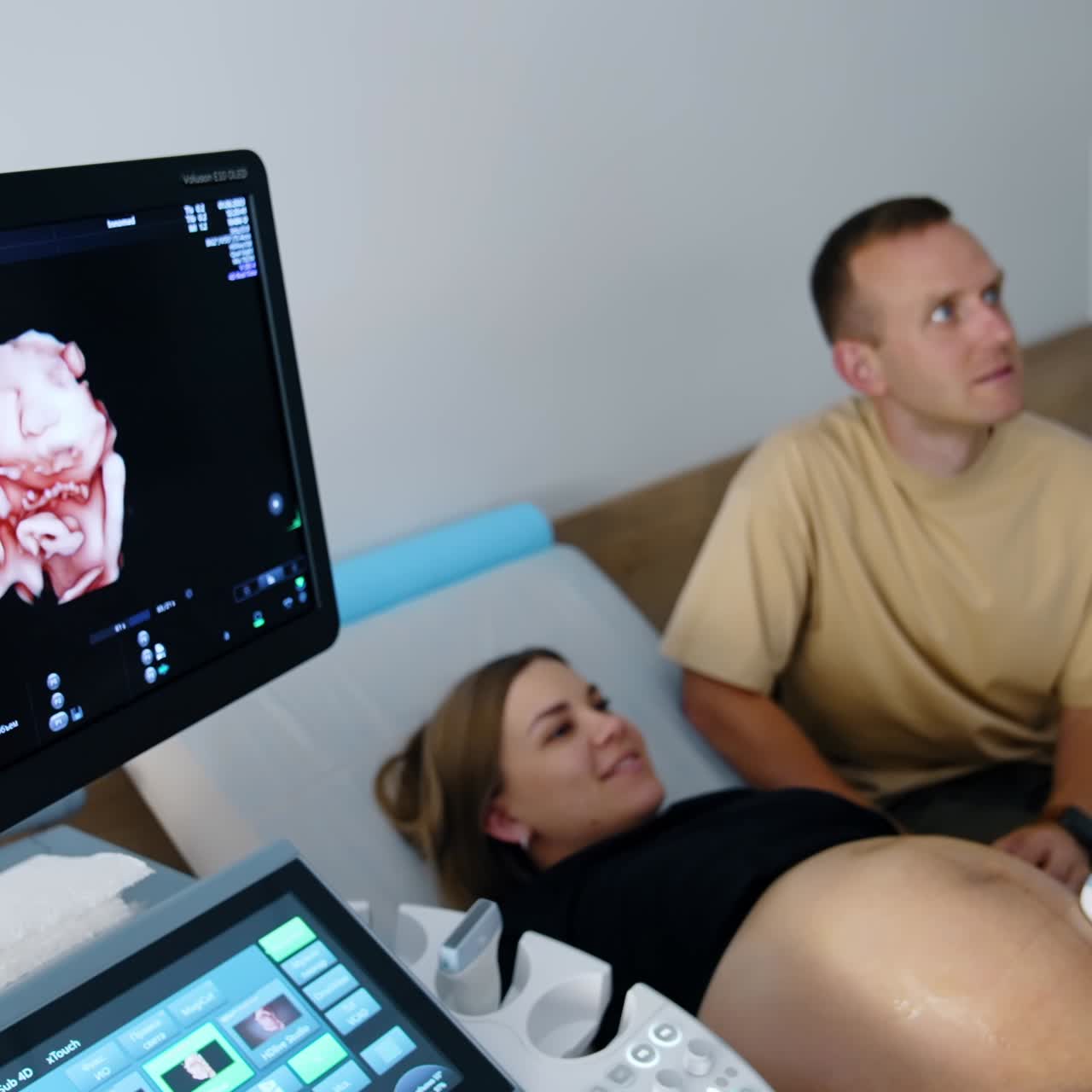 Una donna caucasica incinta si sta sottoponendo a un'ecografia. L'immagine del bambino è sullo schermo nero della macchina.