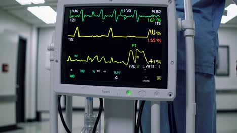 Close-up video shot of a hospital monitor displaying vital signs in a corridor, with a medical