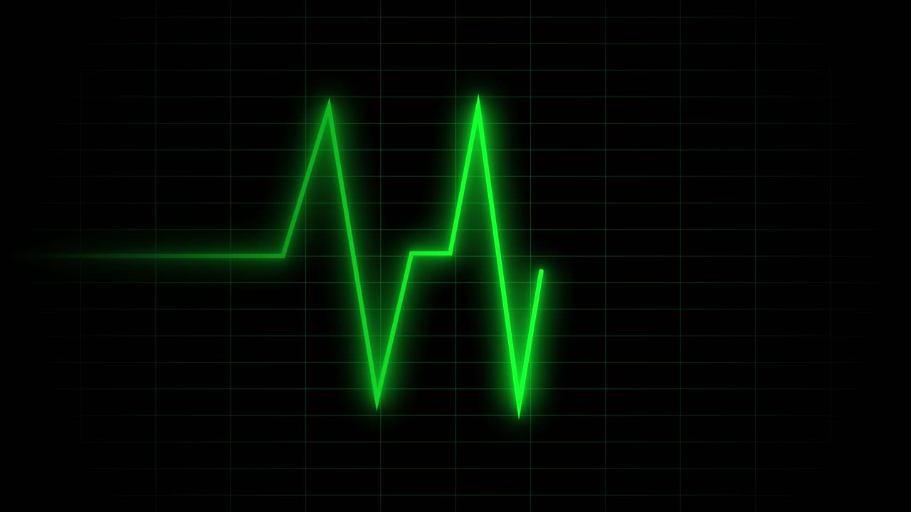 Tracciato cardiaco ECG verde su schermo nero