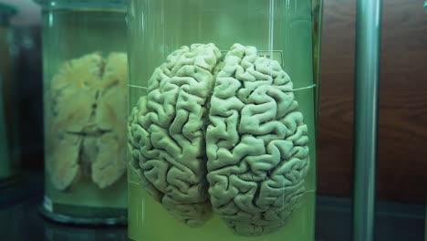 organs in anatomical museum. human organs in jars with formalin in anatomical museum