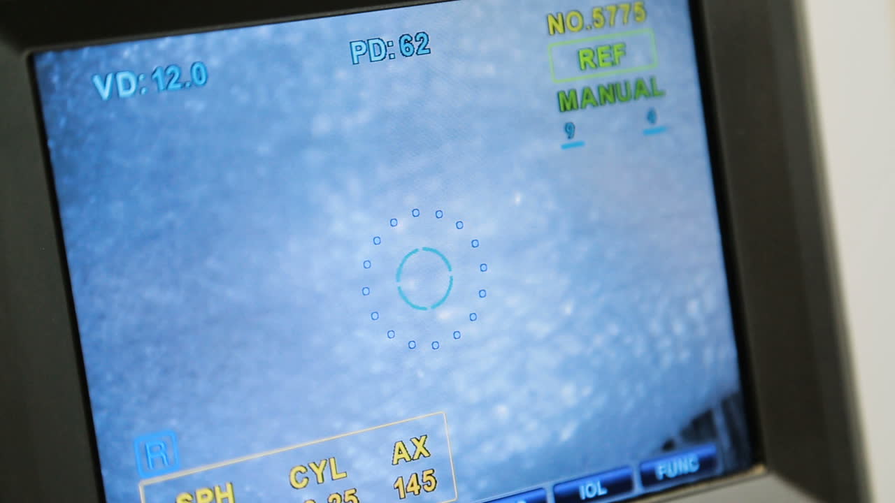 Modern eye testing device. Equipment of modern ophthalmology device in clinic