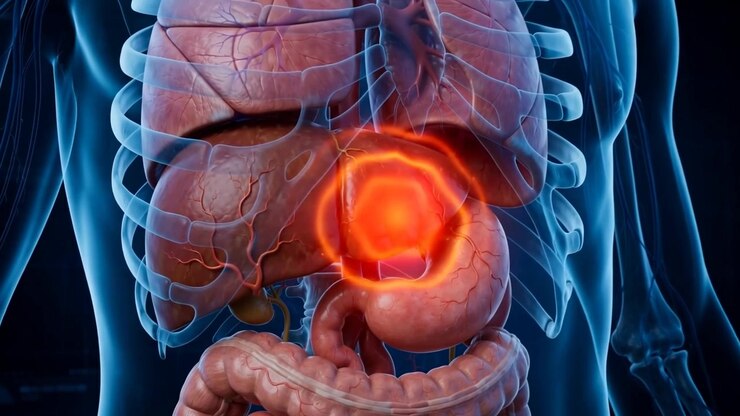 Transparent blue torso showing lungs liver stomach and intestines with a bright orange glowing stomach pain area