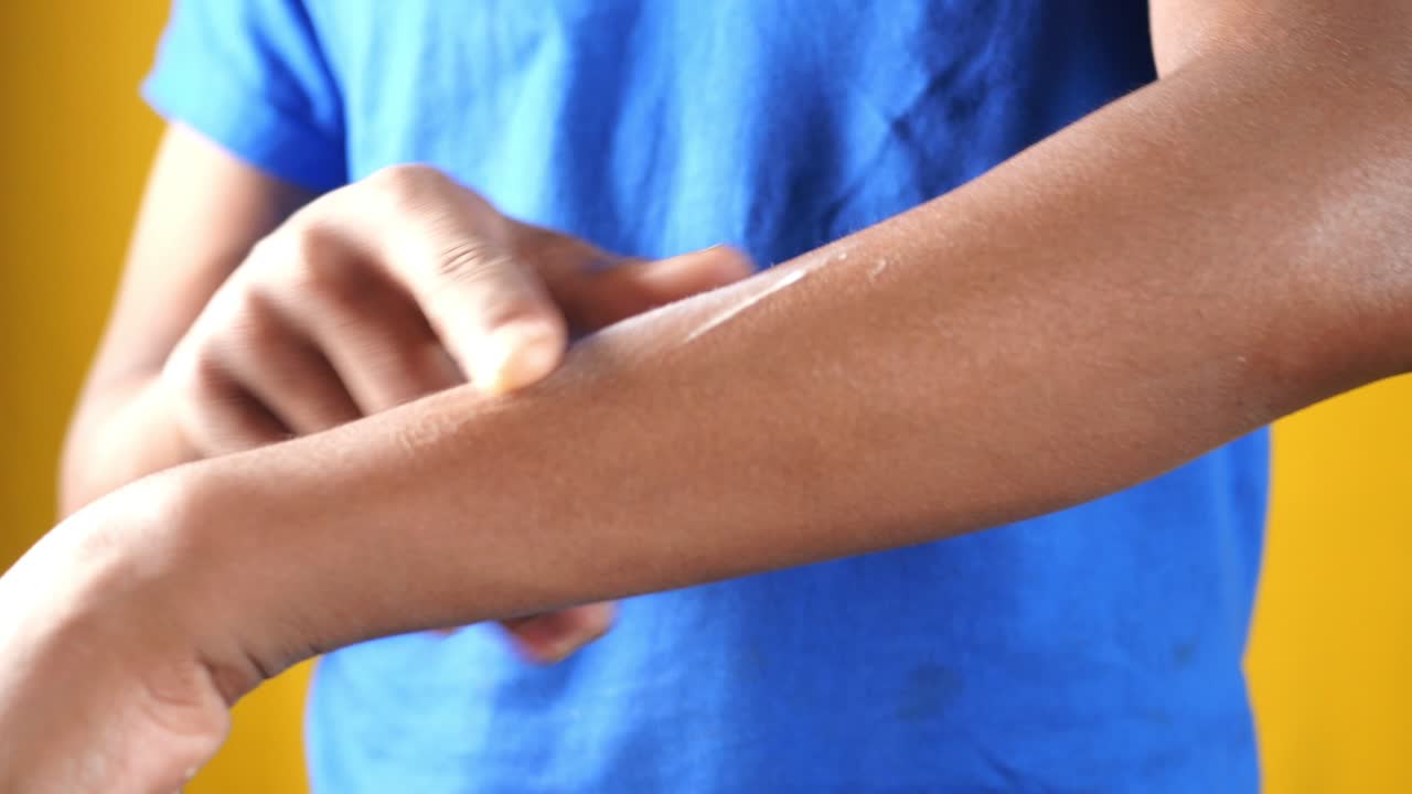 aplicación de loción en el brazo