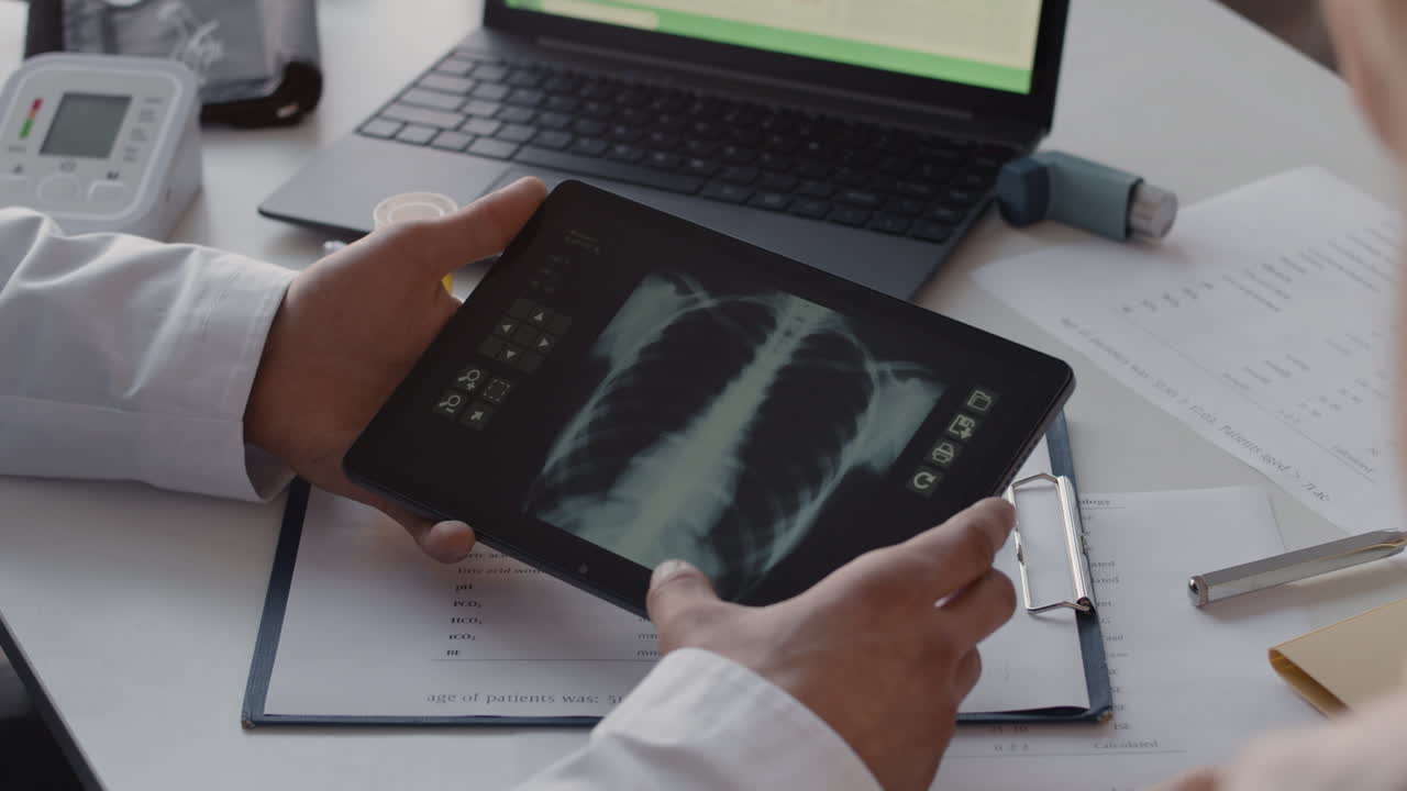 Doctor reviewing chest x-ray on tablet