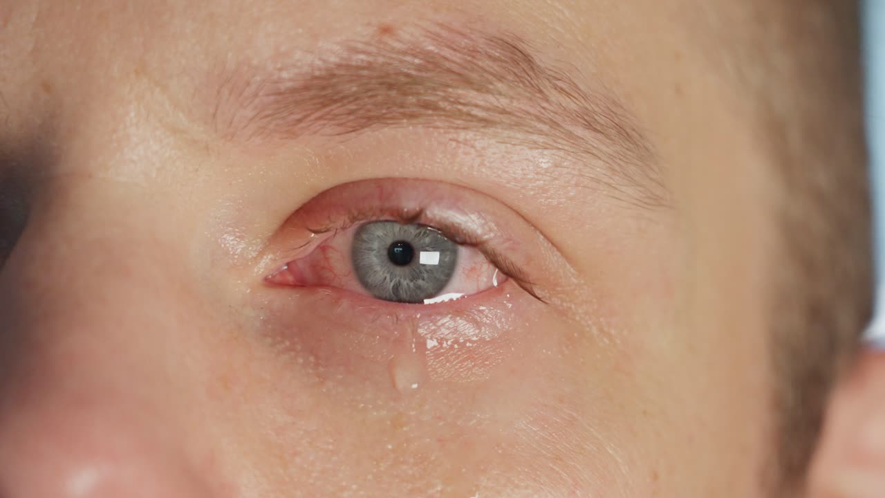 백인 남자의 눈에서 천천히 눈물이 떨어집니다.