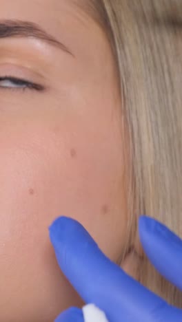 procedimiento de inyección facial