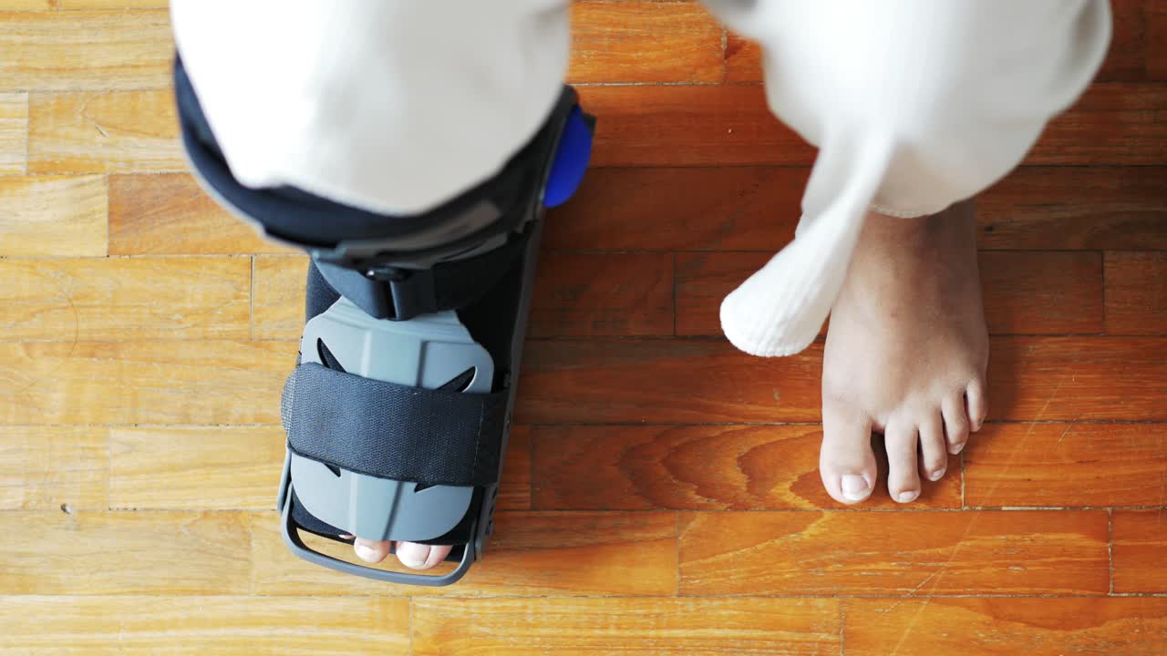 회색 플라스틱 부츠를 입은 여성의 발이 부러져 발목을 보호하는 부츠가 부상을 입었습니다.