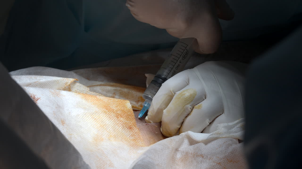 수술적 주사 절차