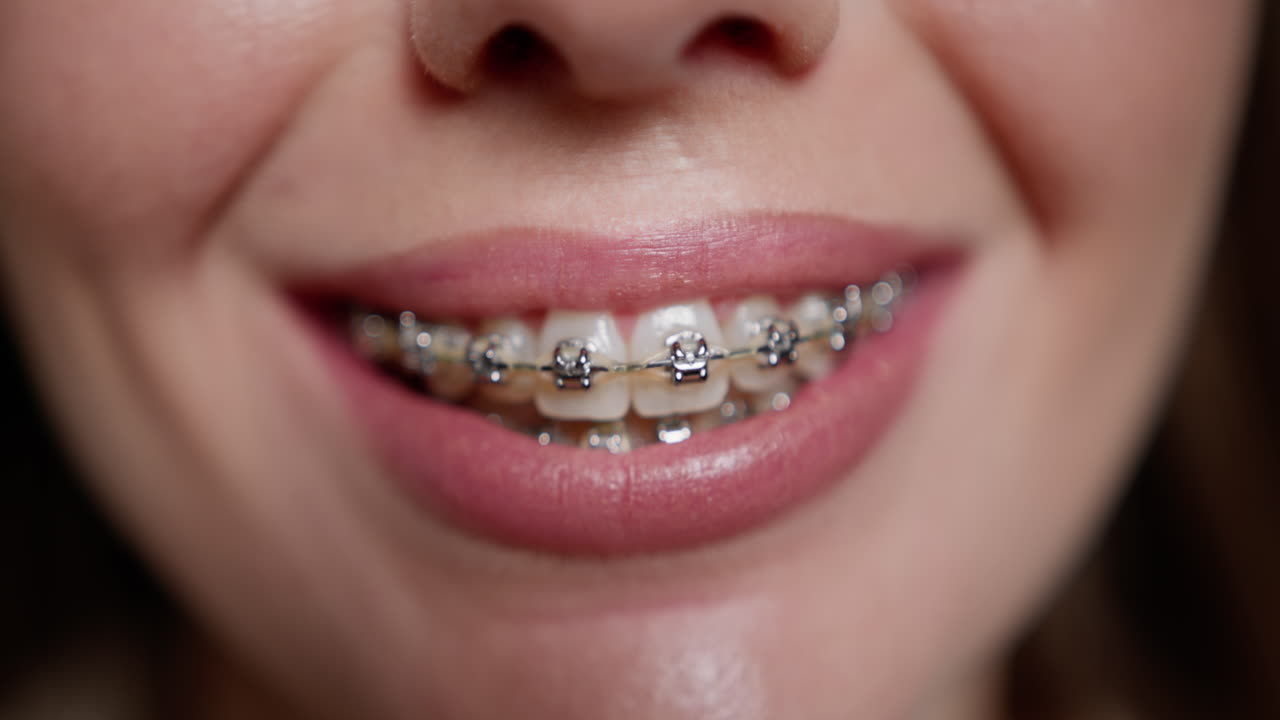 Woman with braces smiling