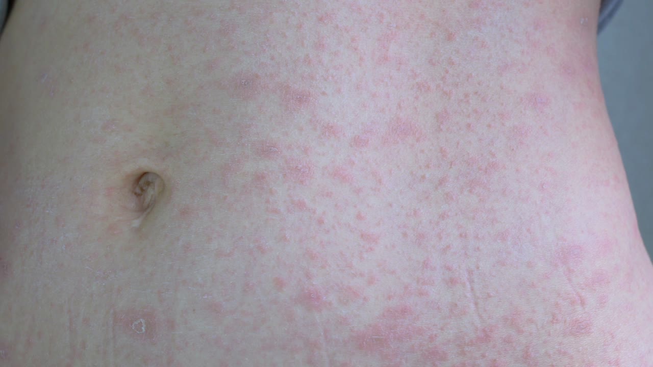 여성은 회색 속옷을 들어 올려서 피부의 문제 부위에  향을 습니다.