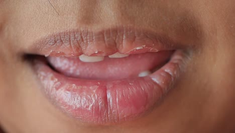 close-up of a person's open mouth