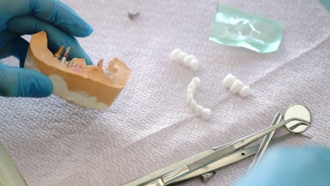 hands of a dentist in medical gloves work with dental implants and crowns in a medical office