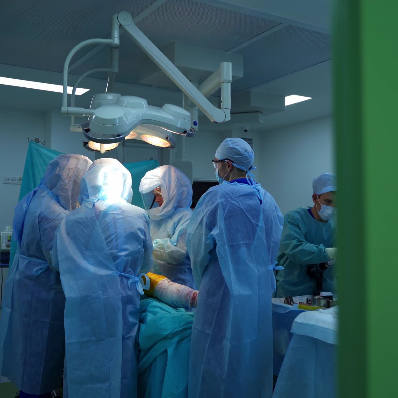 Group of surgeons during the operation. Doctors in safety medical uniform perform a surgery in the modern operating room. View through the window.
