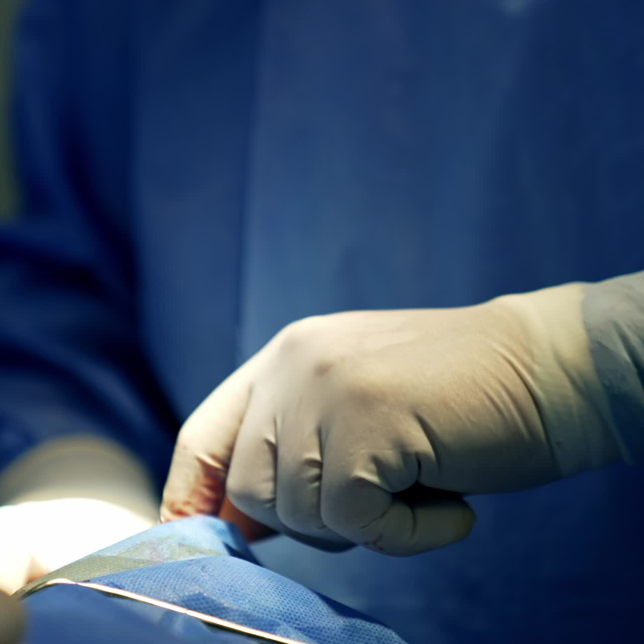 Surgeon's hands in latex gloves deep into the operated area of a patient. Medic working using no tools with hands only. Close up