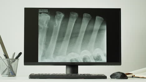 médico que examina las radiografías