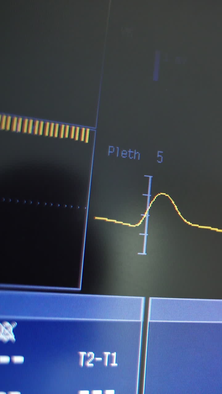 Heart cardiogram and numbers on screen. Yellow line moves at certain heart rate on black screen. Motion of wavy line of cardiogram on monitor. Close-up. Vertical video