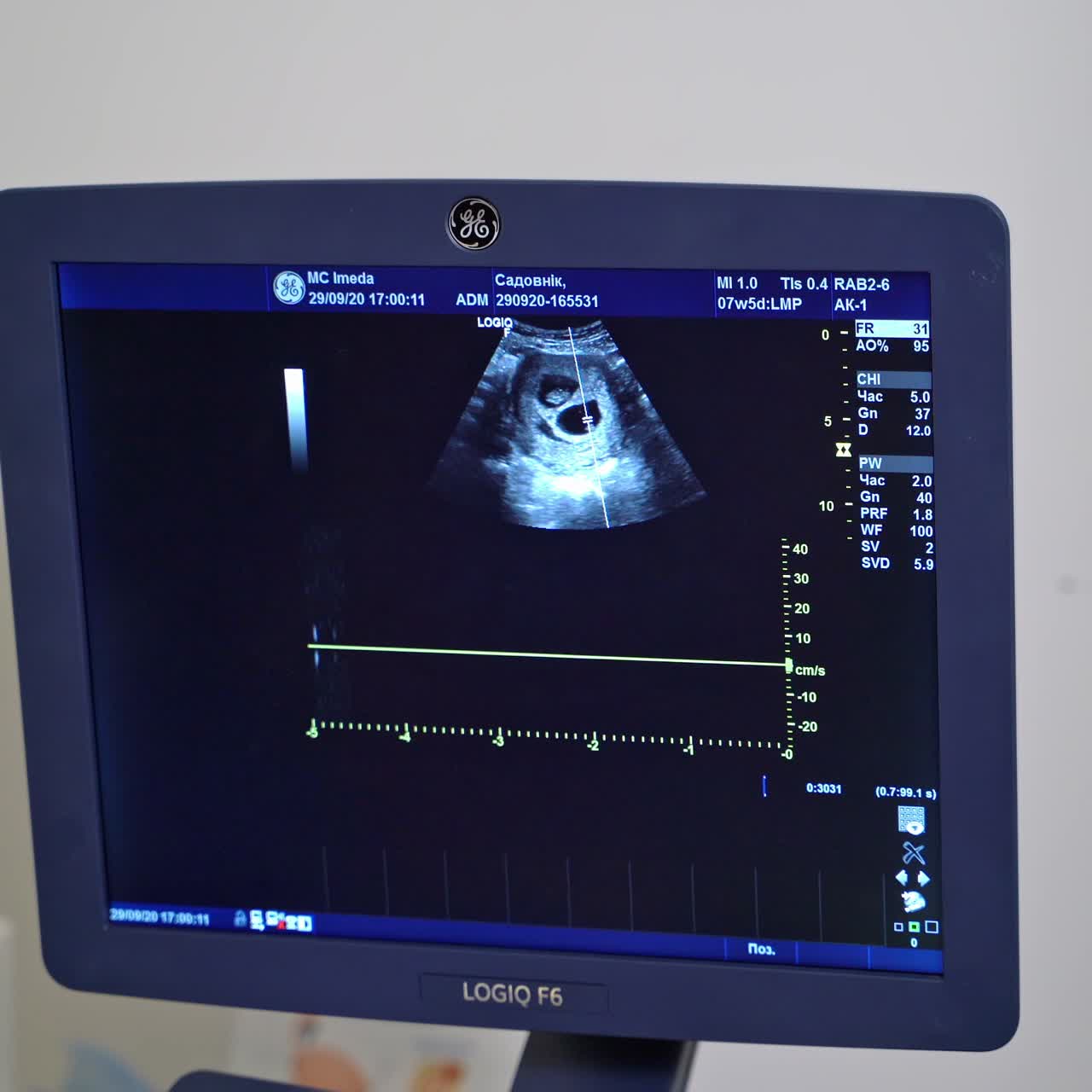 Sonographer using ultrasound machine at work