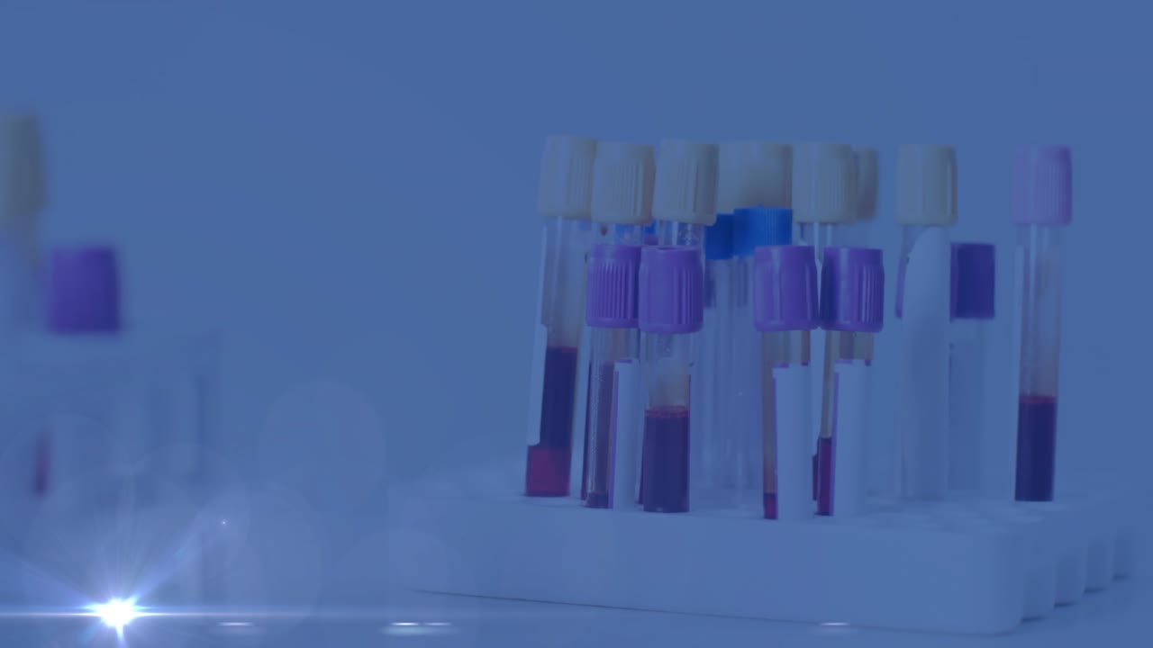 Blood testing concept showing white rack holding colored sample tubes in 3D render with lens flare
