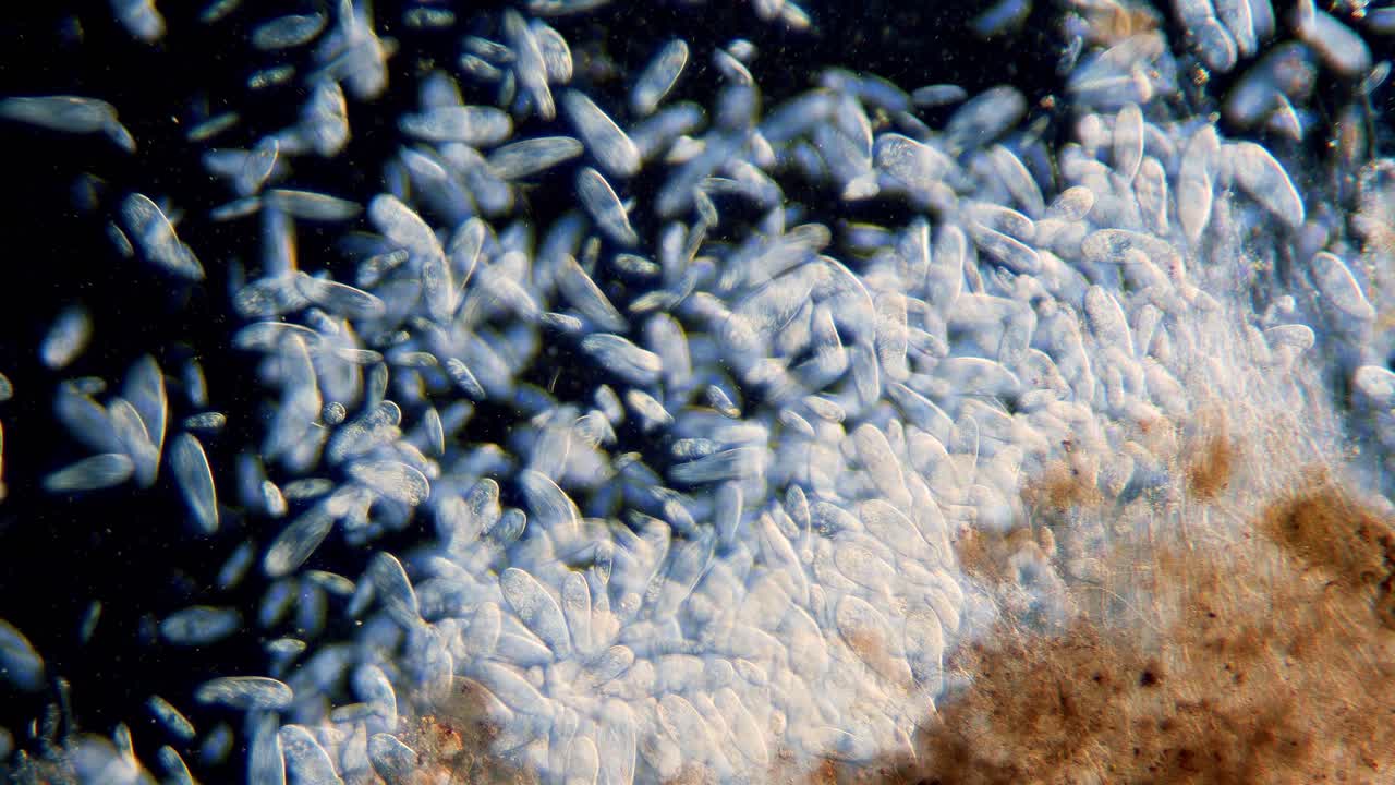 현미경으로 단세포 짚신 원생동물의 고밀도