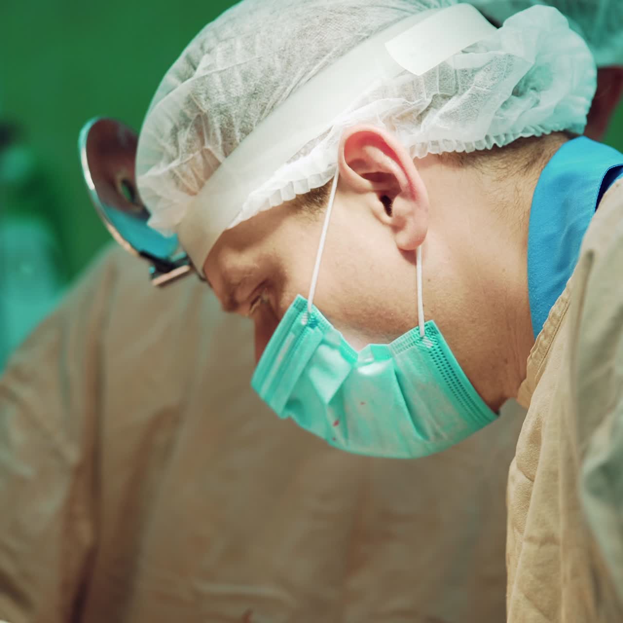 surgeon in the mask focuses on the operation in the hospital in the surrounded by colleagues. Close-up