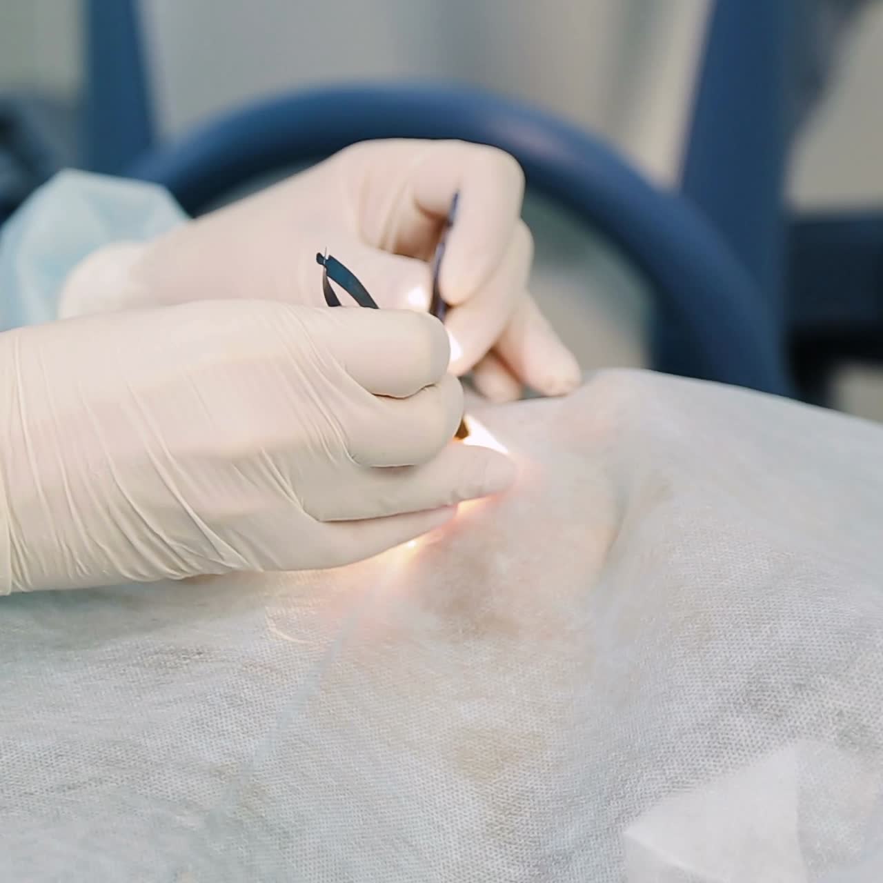 Laser vision correction