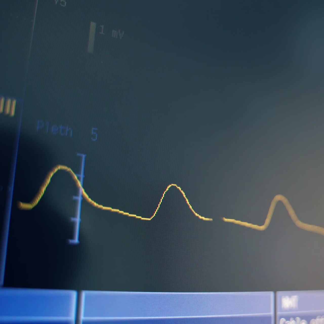 Monitoring of patient condition. Patient heart beat and blood pressure placed on patient during surgery operation