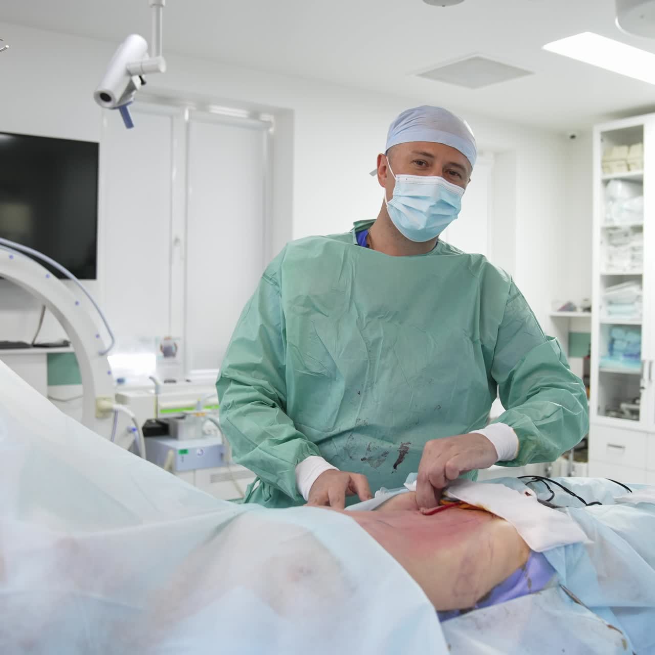 Fine dell'operazione di liposuzione. Il chirurgo esegue le procedure finali prima che il paziente si svegli. Il medico pulisce l'addome del paziente e commenta l'operazione.