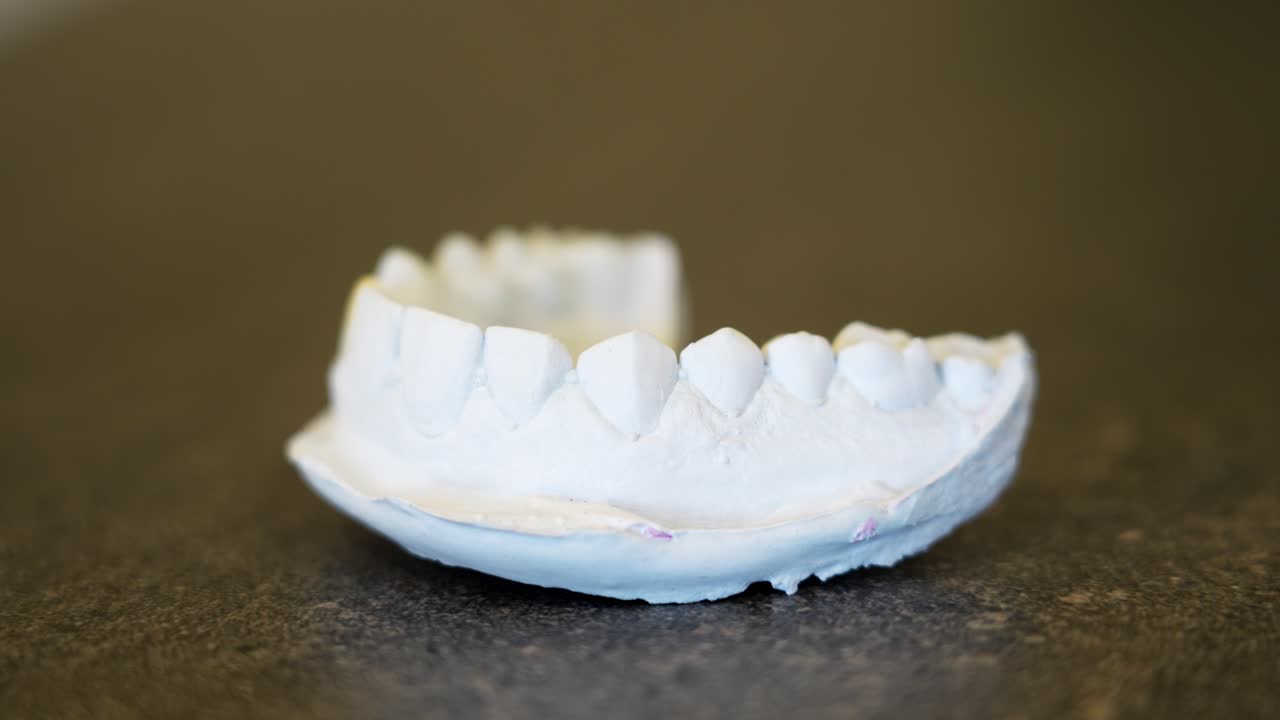 Close-up of a plaster dental mold used for dental restoration