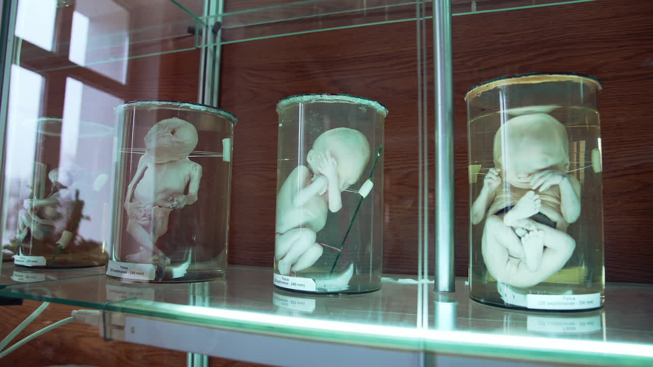 Fetus in formalin solution in museum. Human organs in jars with formalin in anatomical museum