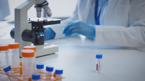 primer plano de un trabajador de laboratorio que realiza investigaciones con un microscopio sosteniendo una muestra de sangre etiquetada como tipo o