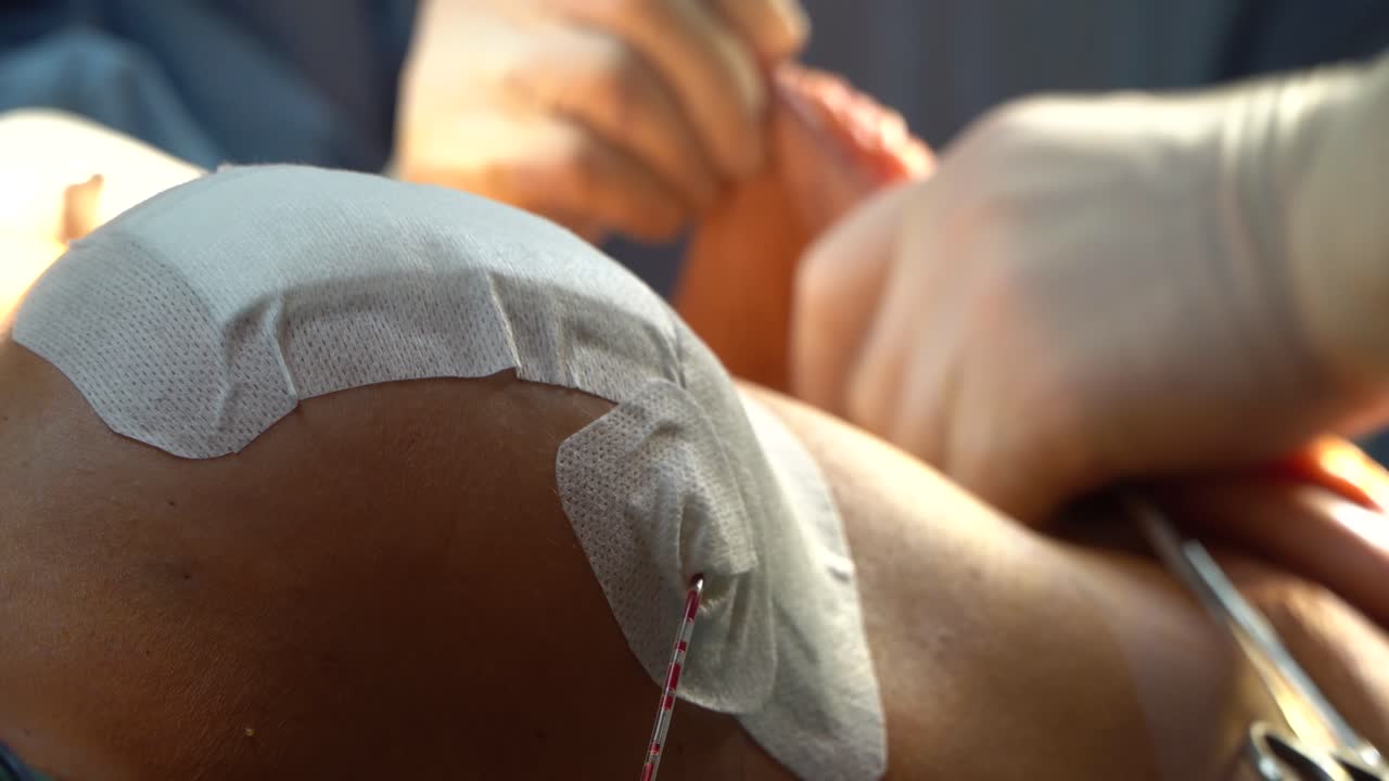 유방 리프트 수술은 자신의 모습을 재구성하고 젊어지게 하고 더 젊어 보이는 프로필을 복원하며 자아 이미지를 향상시키는 훌륭한 방법입니다.