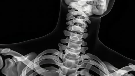 an x-ray reveals the intricate structure of the cervical spine and surrounding upper body area.