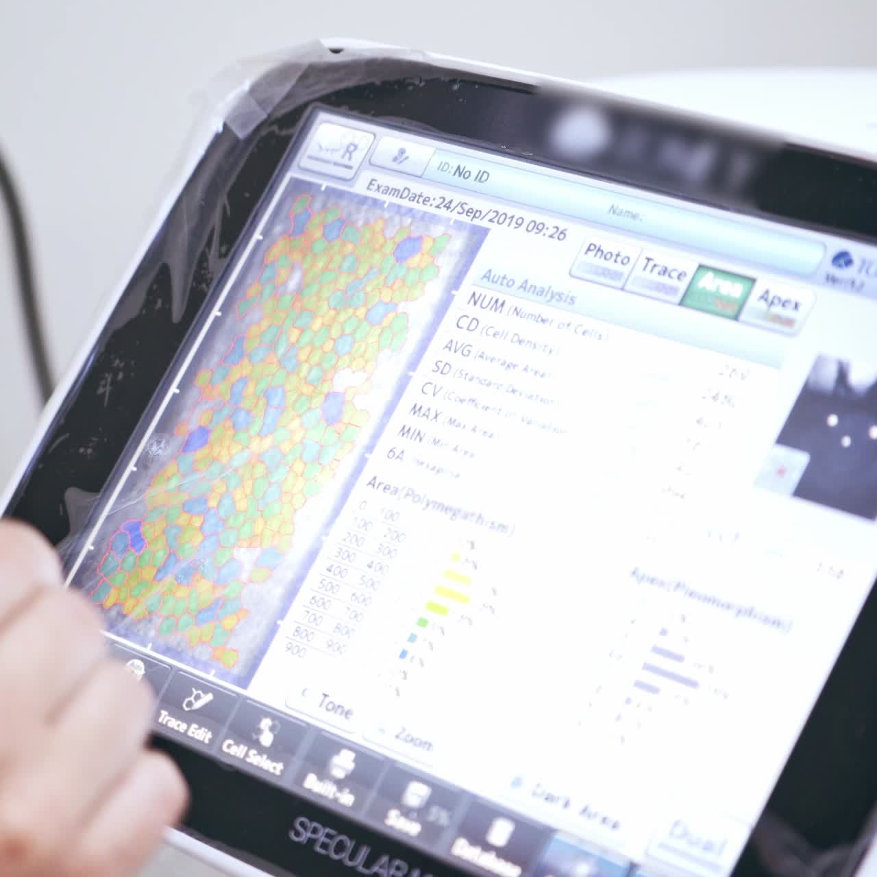 Equipment for checking vision