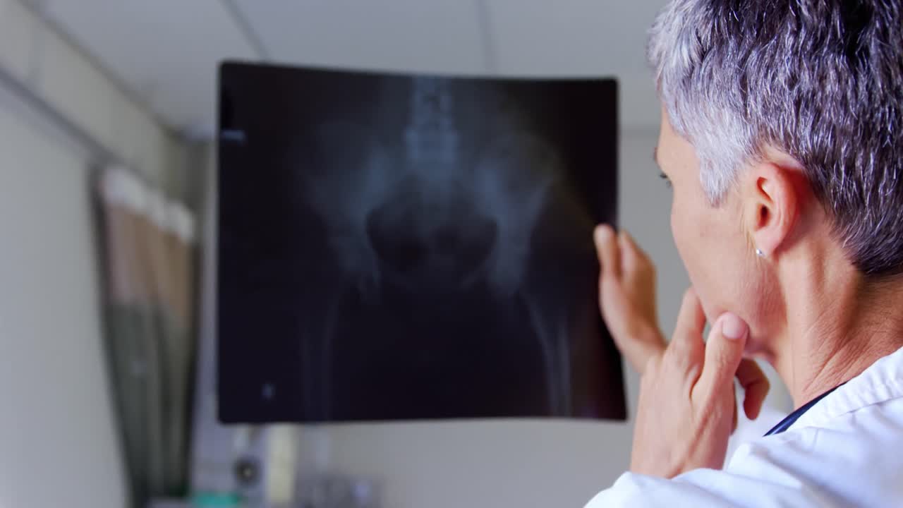 Kvindelig læge undersøger røntgenrapport 4k