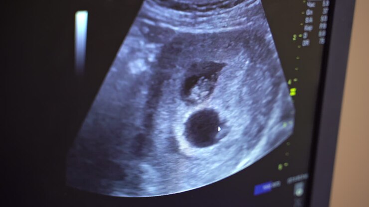 Sonography. The screen of the ultrasound machine. Results of the ultrasound on the monitor. Health care concept.