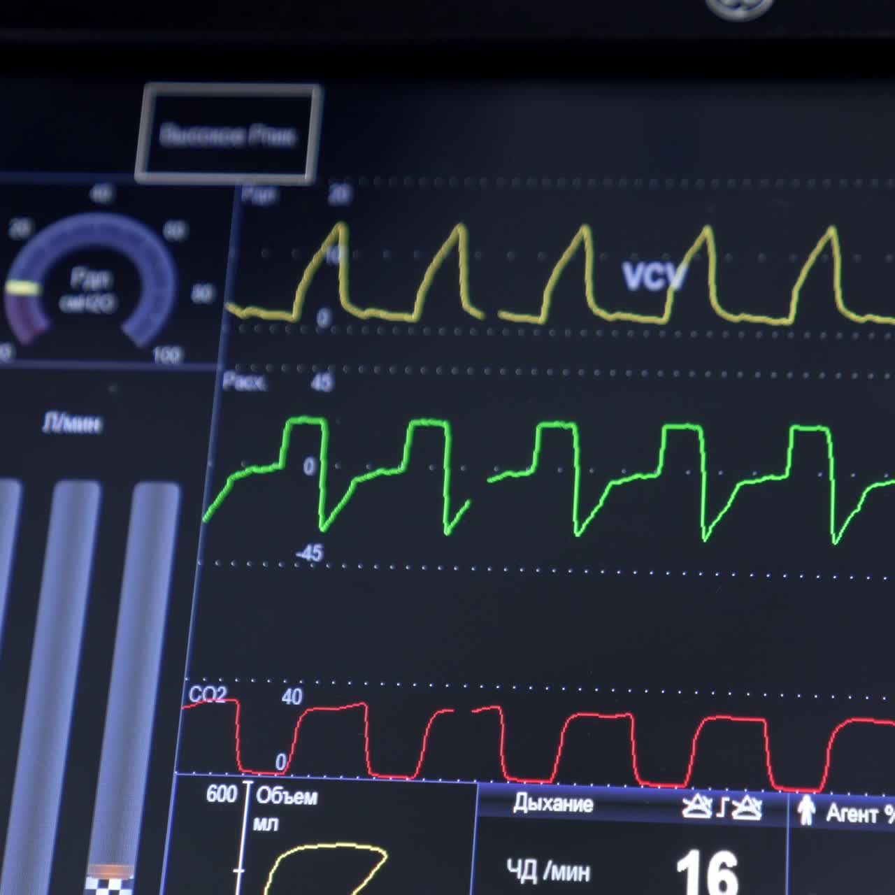 Moving curved lines of heart rate on the black screen of equipment. Life parameters of a patient at surgery. Close up