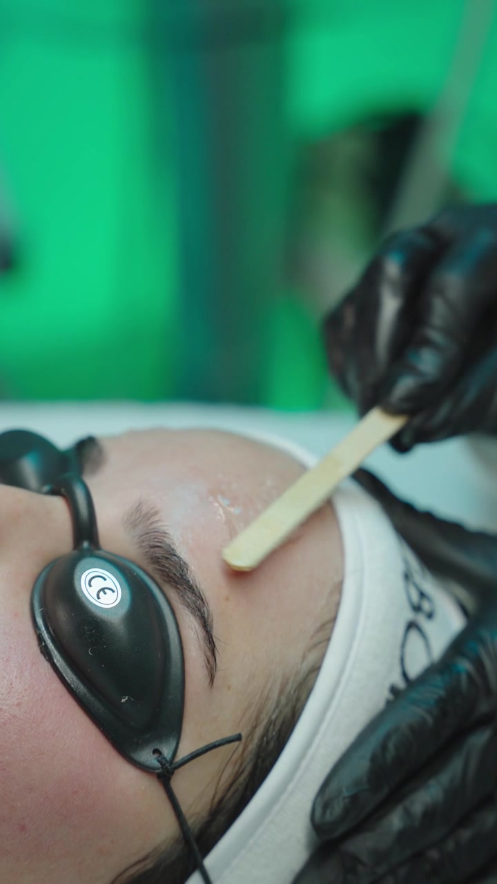 Kühlgel wird auf die Stirn eines Patienten aufgetragen vor einer Laserbehandlung zur Pigment- oder Haarentfernung in einem professionellen klinischen Umfeld